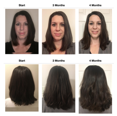 Up Hair Growth System Results previously Volumique Hair Growth solution