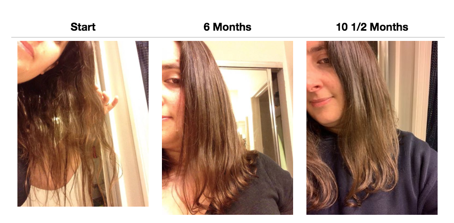 6-Month Hair Growth Bundle | FullyVital